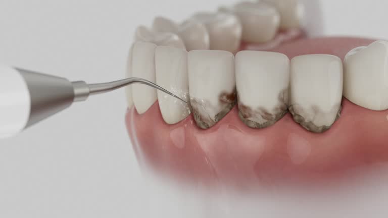 Reliable Dental contractor in Marion, AL by Smile Center Dentistry